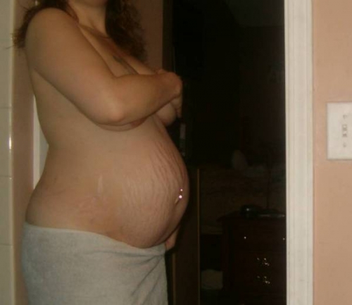 растяжки на животе на 28 неделе беременности